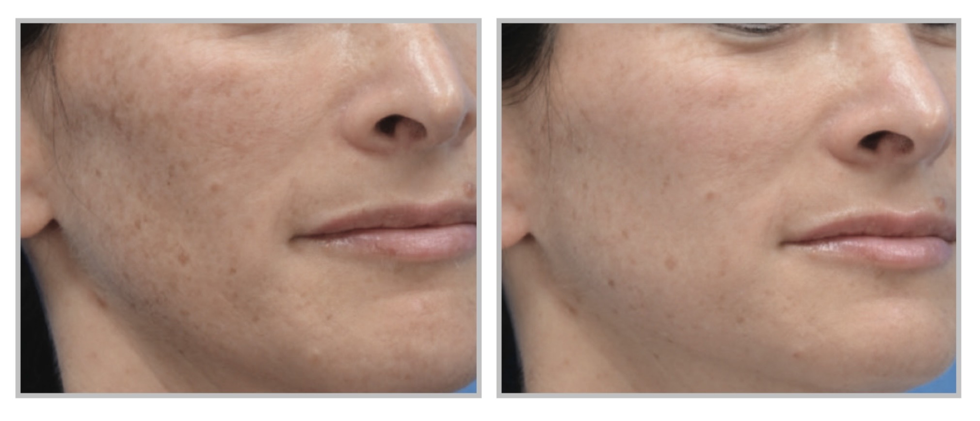 MOXI_B&A