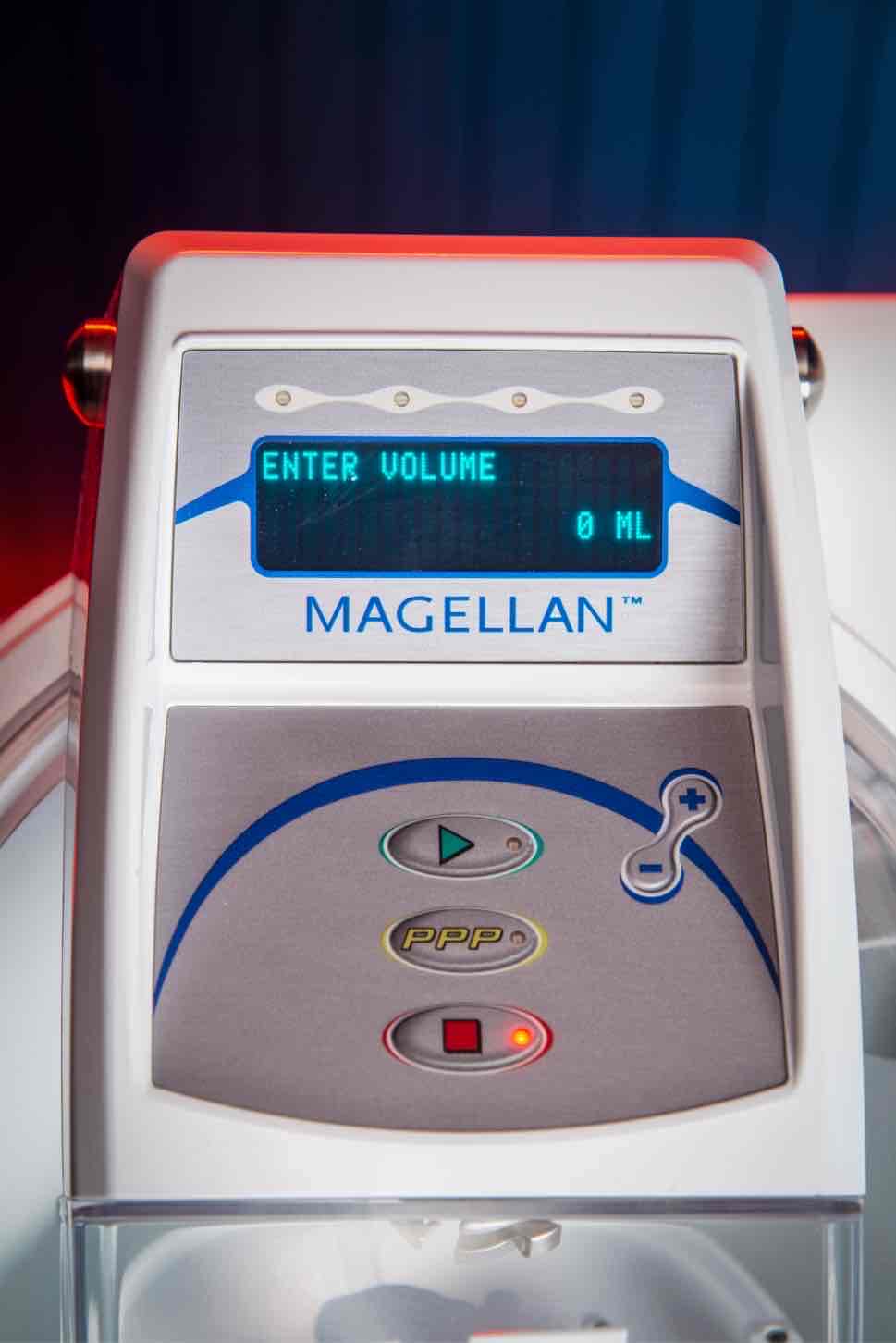 Какъв е ефектът след процедура с Magellan®?