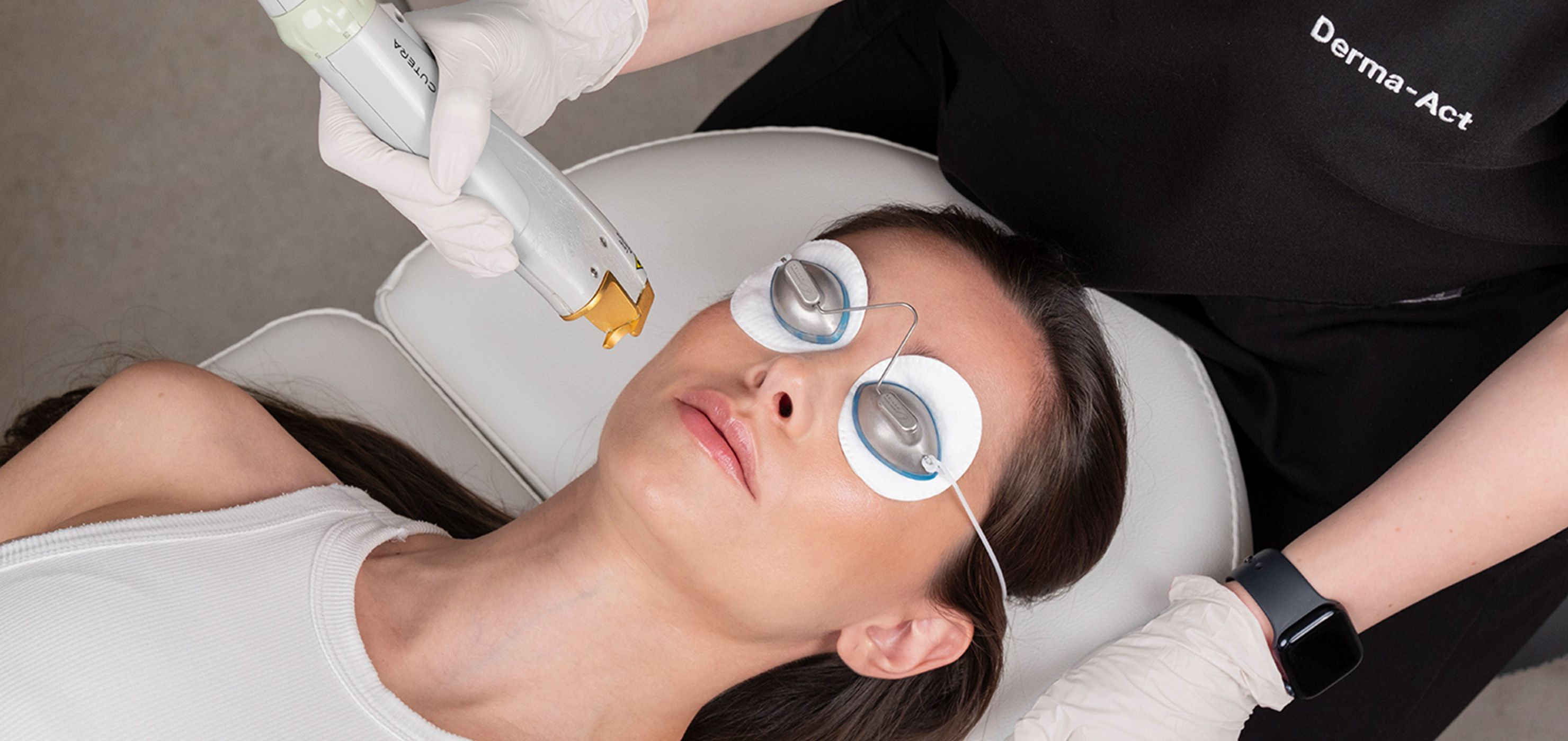 Акне — процедура в Derma-Act