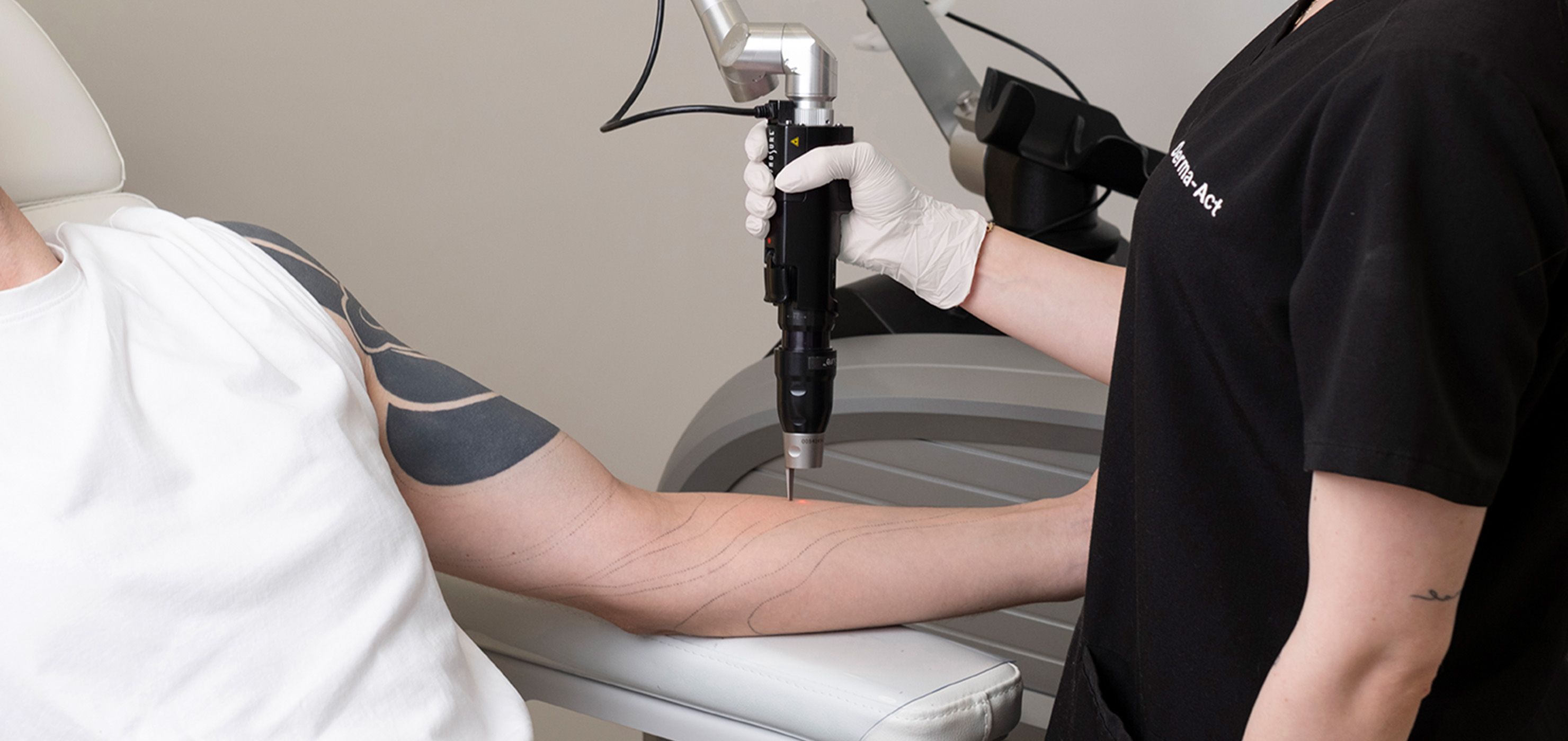 Премахване на татуировки и перманентен грим с PicoSure® Pro — процедура в Derma-Act