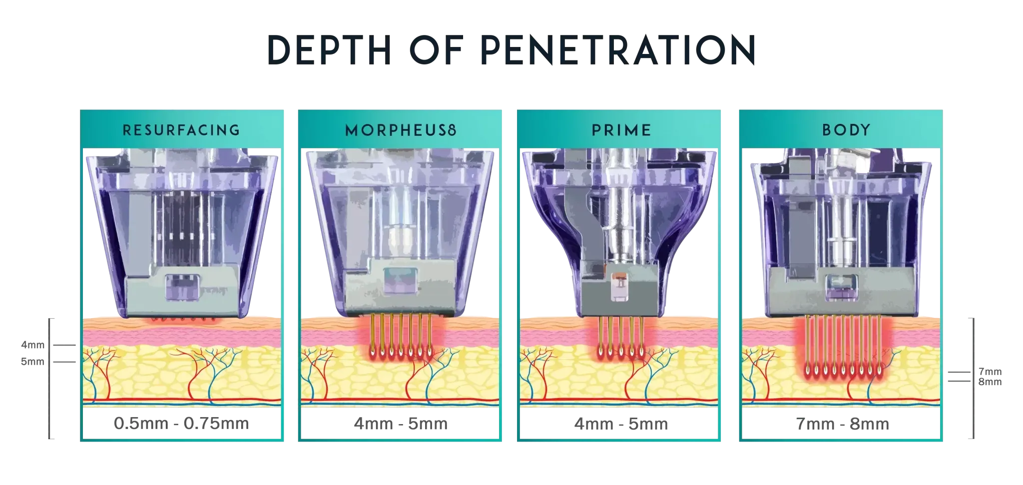Как протича процедурата?
