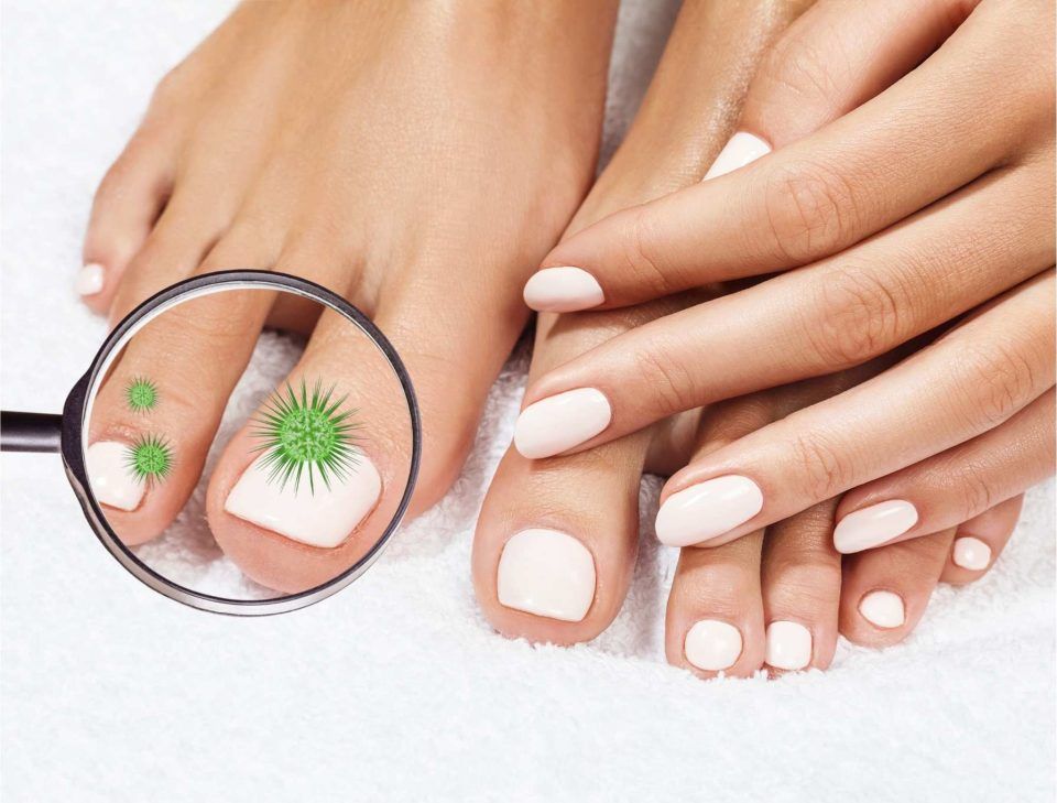 Гъбички по ноктите: Причини, рискове и лечение